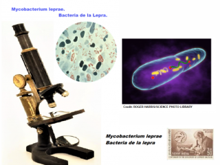 Bacilo acidorresistente con forma de curva. La lepra es una enfermedad curable. Si se trata en las primeras fases, se puede evitar la discapacidad.